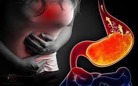 Trào ngược dạ dày ở người lớn tuổi – Căn bệnh “âm thầm” gây mệt mỏi kéo dài