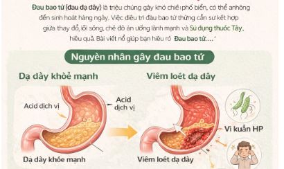 Liều thuốc tây đau bao tử (đau dạ dày) Liều thuốc tây đau bao tử (đau dạ dày)