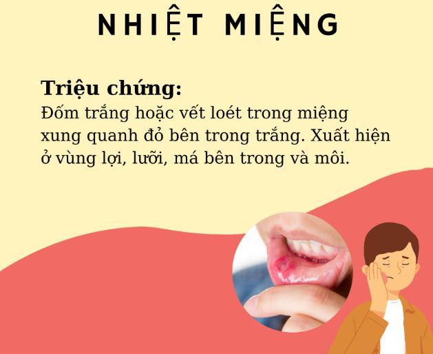 Liều thuốc Tây điều trị nhiệt miệng (tham khảo) Liều thuốc Tây điều trị nhiệt miệng (tham khảo)