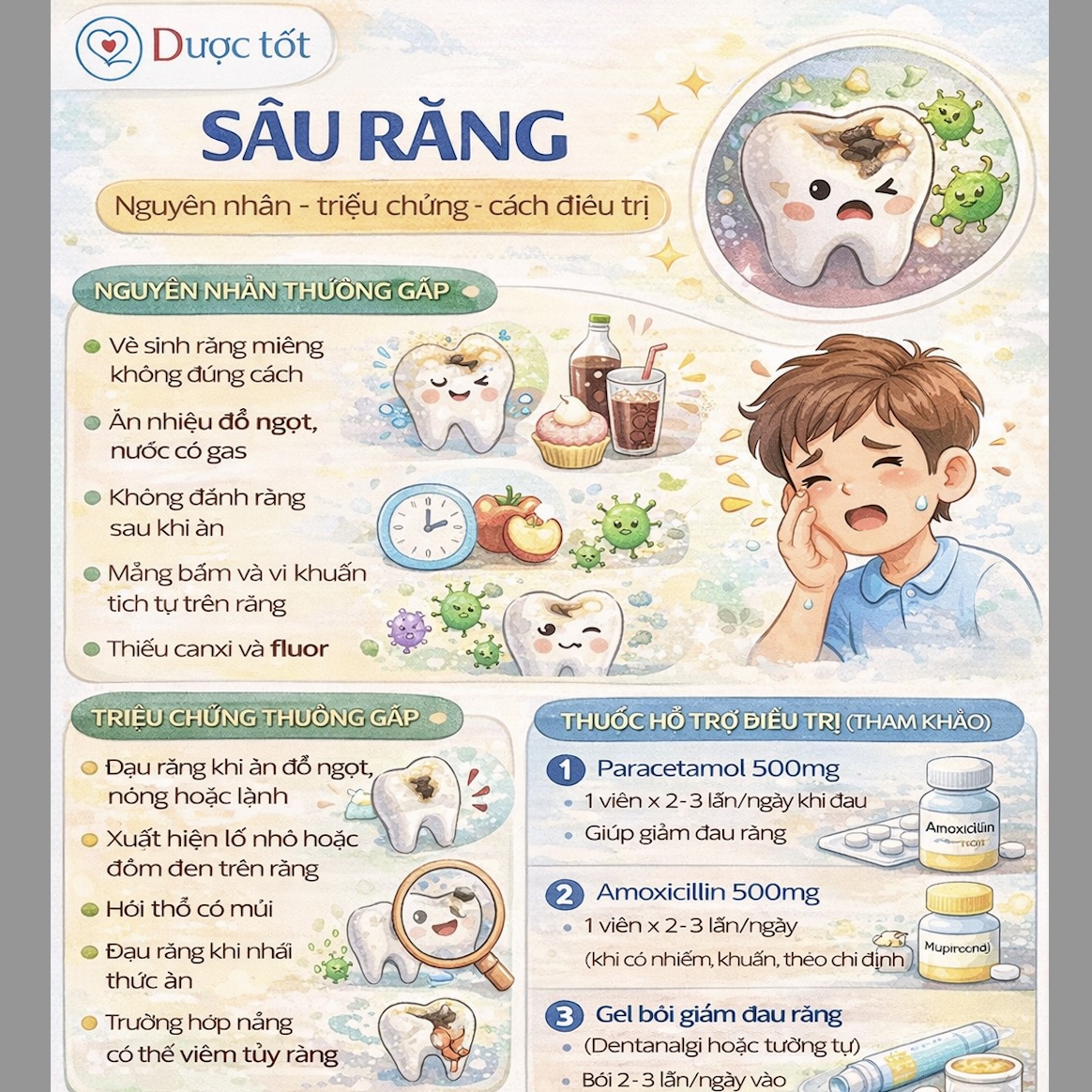 Sâu răng gây ê buốt Sâu răng gây ê buốt
