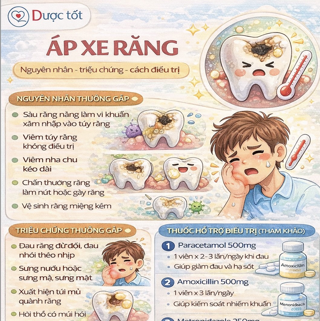 Áp xe răng và cách điều trị Áp xe răng và cách điều trị