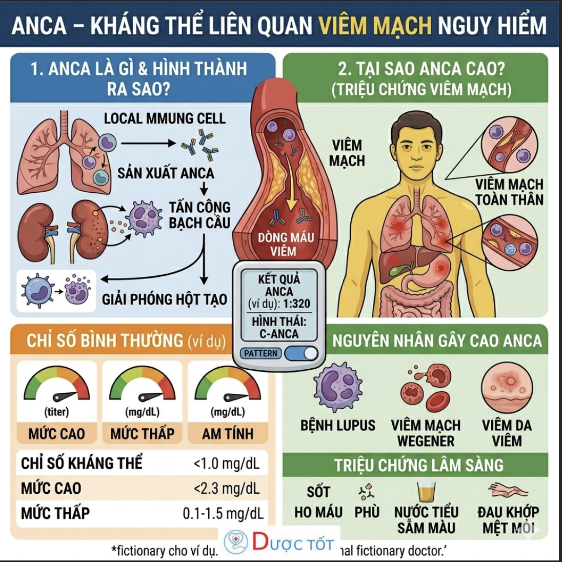 ANCA – KHÁNG THỂ LIÊN QUAN VIÊM MẠCH NGUY HIỂM