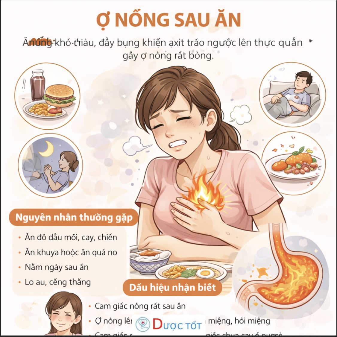 Ợ NÓNG SAU ĂN – DẤU HIỆU DẠ DÀY ĐANG “KÊU CỨU”
