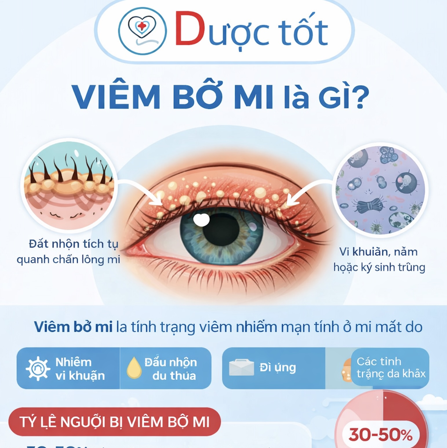 Viêm bờ mi là gì? Viêm bờ mi là gì?