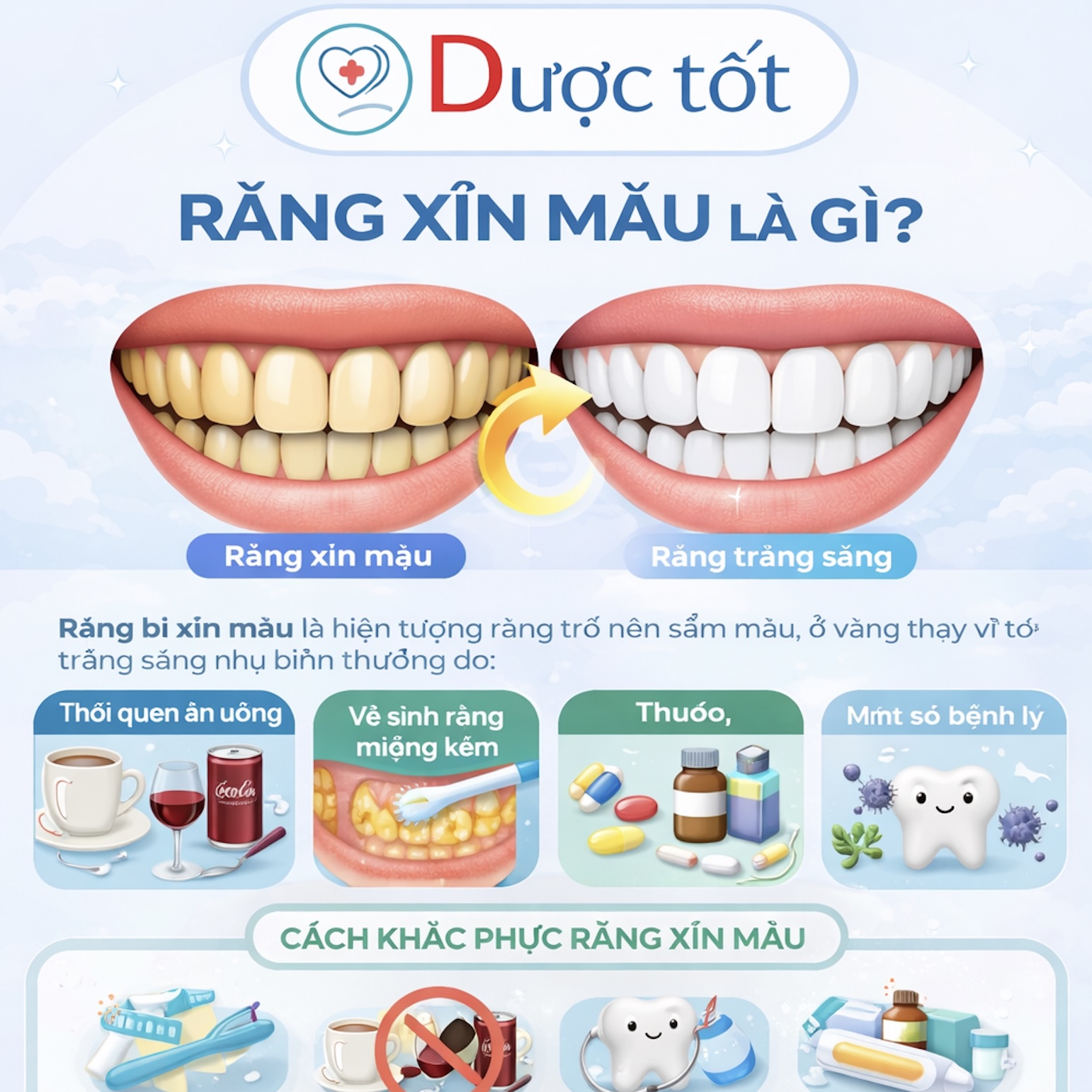 Răng xỉn màu là gì? Răng xỉn màu là gì?