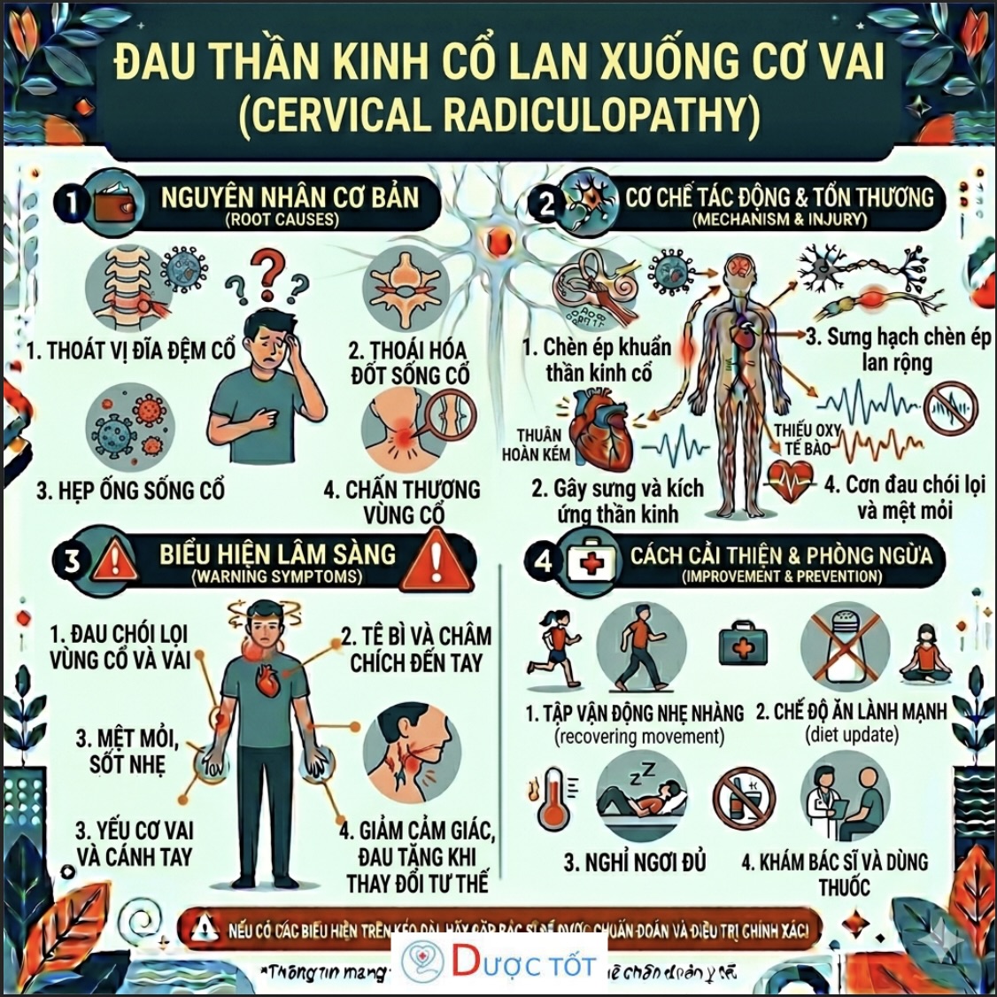 Đau thần kinh cổ lan xuống vai tay