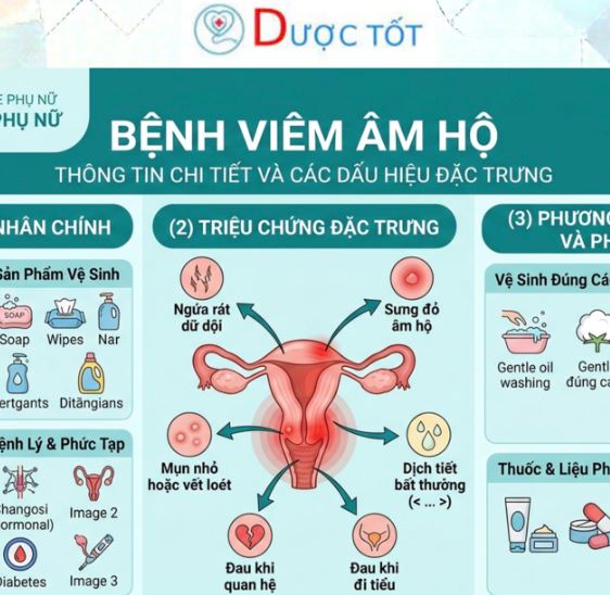 Tình trạng viêm âm hộ