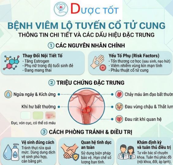 Điều trị viêm lộ tuyến cổ tử cung Điều trị viêm lộ tuyến cổ tử cung