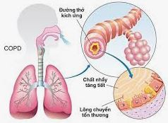 Điều trị thở nông do stress