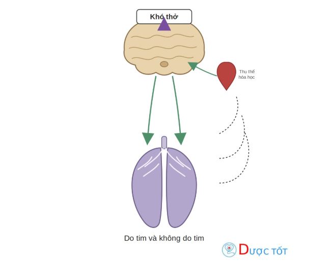 Khó thở do tim và không do tim: Phân biệt, cách xử trí