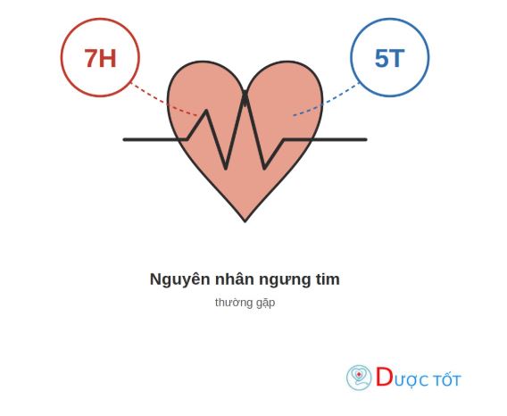 Nguyên nhân ngưng tim thường gặp: 7H và 5T