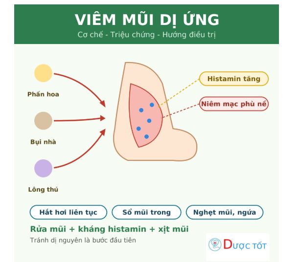 Viêm mũi dị ứng: nguyên nhân, triệu chứng và cách điều trị