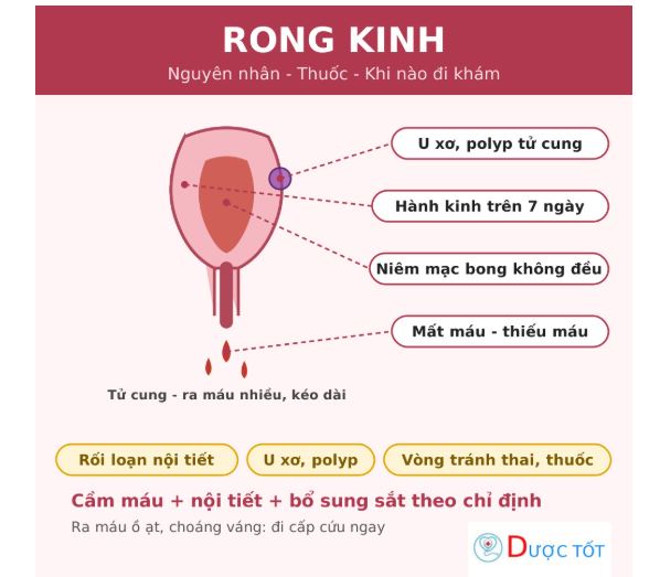 Rong kinh: nguyên nhân, cách điều trị và khi nào cần đi khám