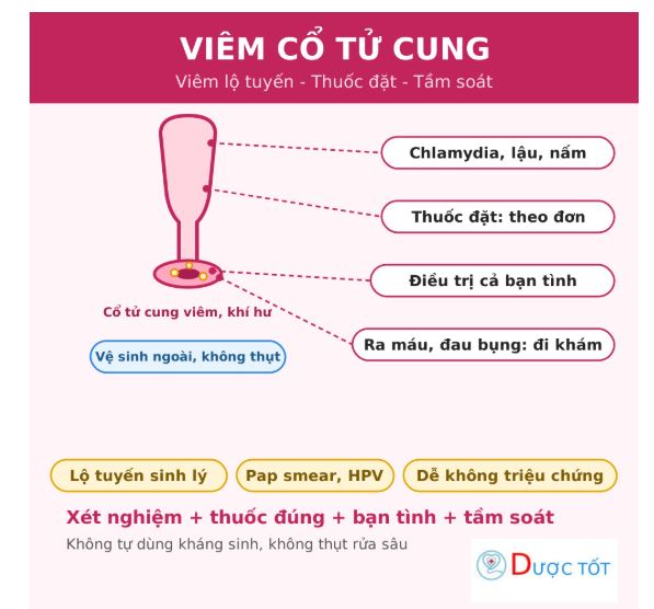 Viêm cổ tử cung nguyên nhân cách điều trị và phòng ngừa