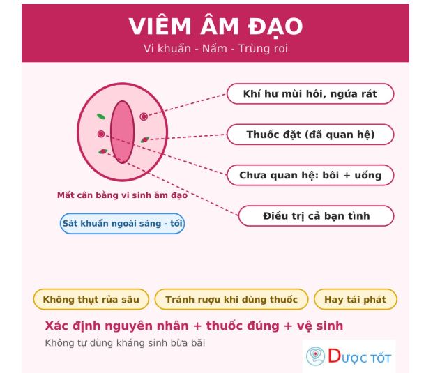 Viêm âm đạo: nguyên nhân, cách điều trị và vệ sinh đúng cách