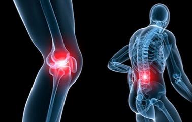 Thoái hóa khớp ở người cao tuổi – Khi khớp xương kêu cứu