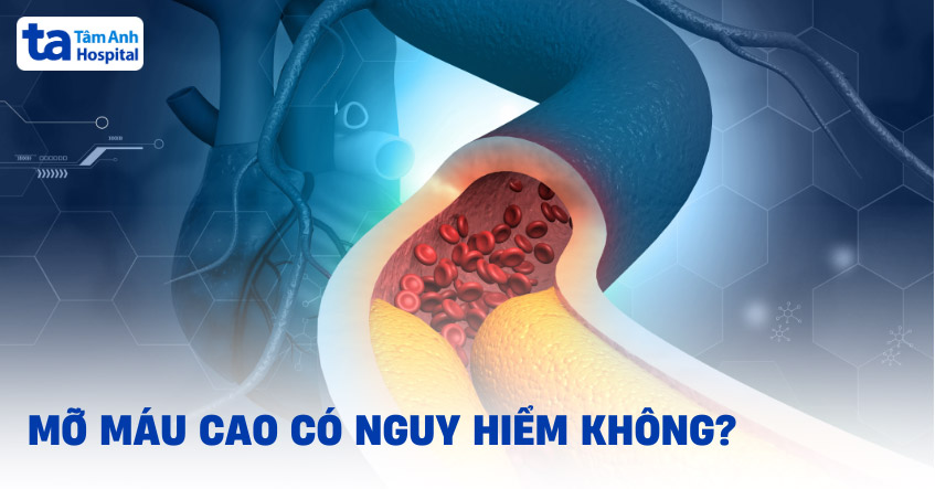 Rối loạn mỡ máu ở người trung niên và cao tuổi – Hiểm họa tiềm ẩn cho tim mạch