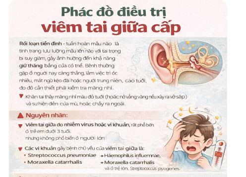 Liều dùng kháng sinh trong điều trị viêm tai giữa (người lớn)