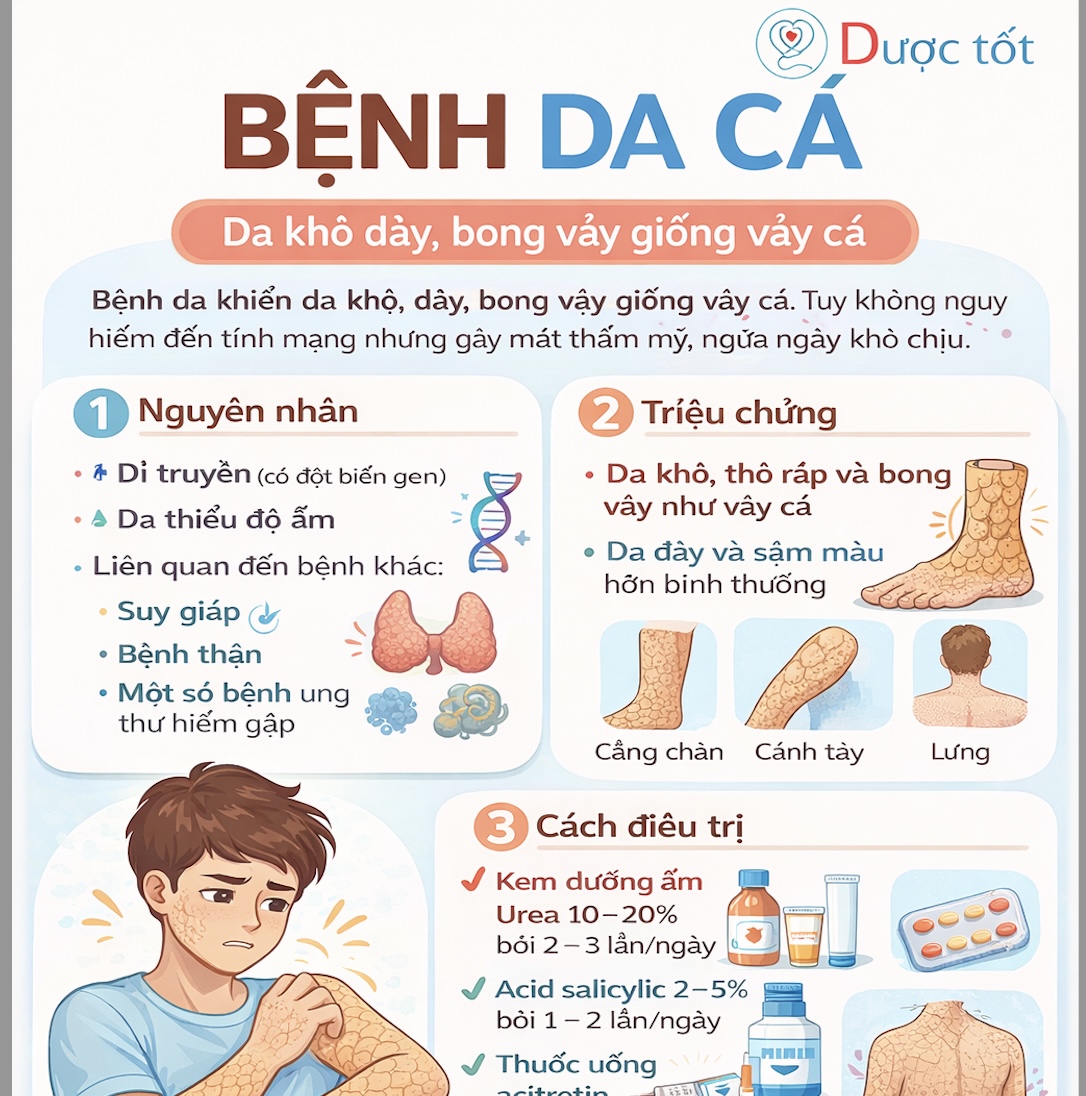 Hội chứng Bệnh da cá (Ichthyosis) 