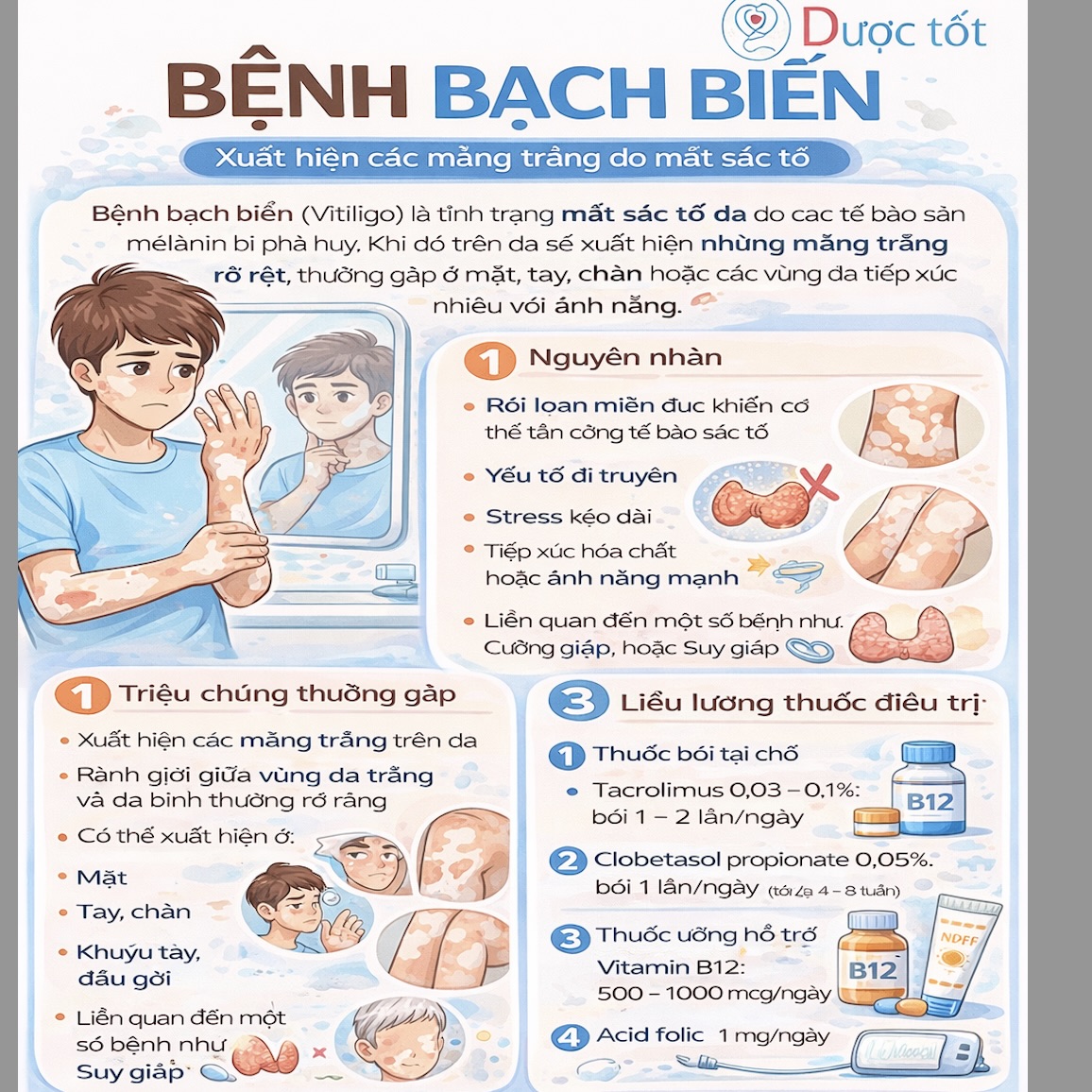 Bệnh bạch biến (Vitiligo) & Thuốc điều trị