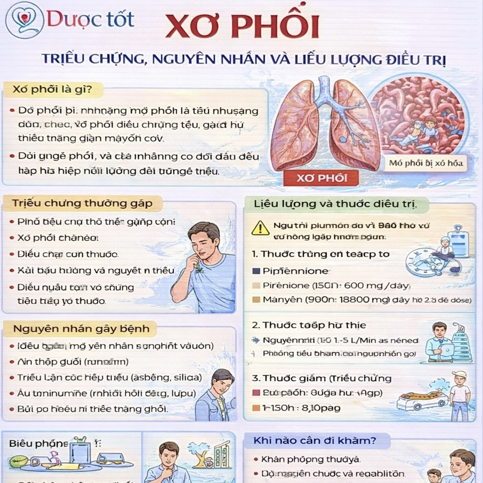 Điều trị Xơ phổi