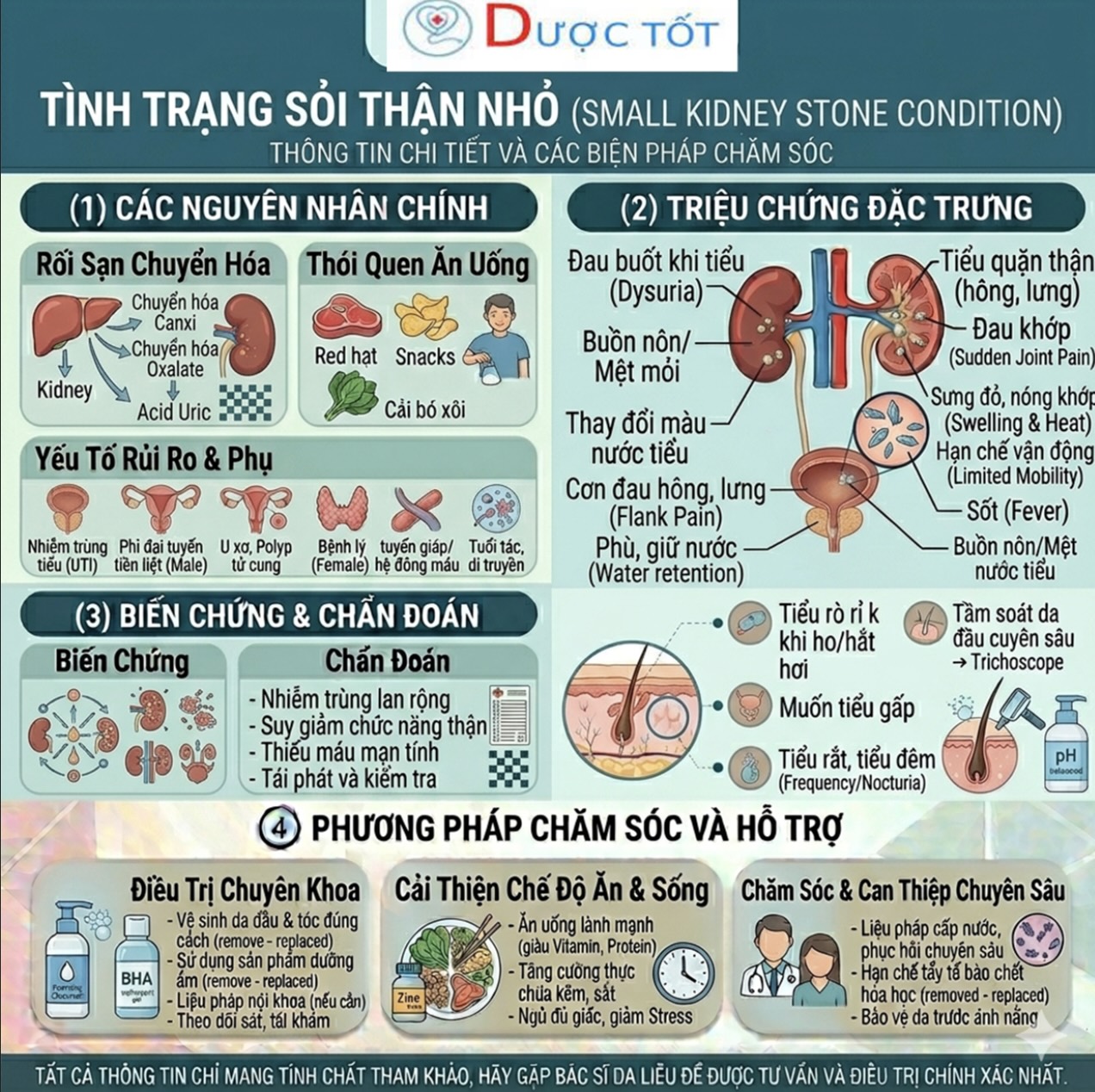 TÌNH TRẠNG SỎI THẬN NHỎ (<5mm)  & CÁCH ĐIỀU TRỊ