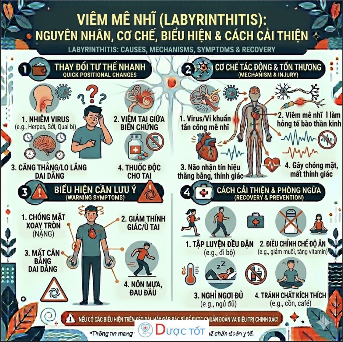 Viêm mê nhĩ (labyrinthitis)