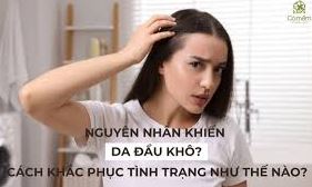 Điều trị da đầu khô do thiếu dưỡng chất