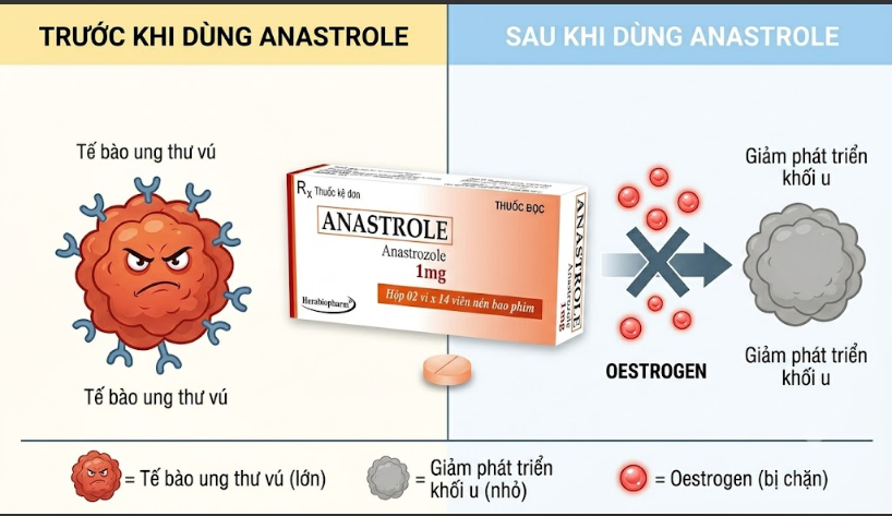 Thuốc điều trị ung thư ANASTROLE Thuốc điều trị ung thư ANASTROLE