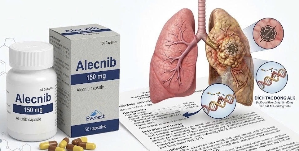 thuốc alecnib 150mg điều trị ung thư phổi