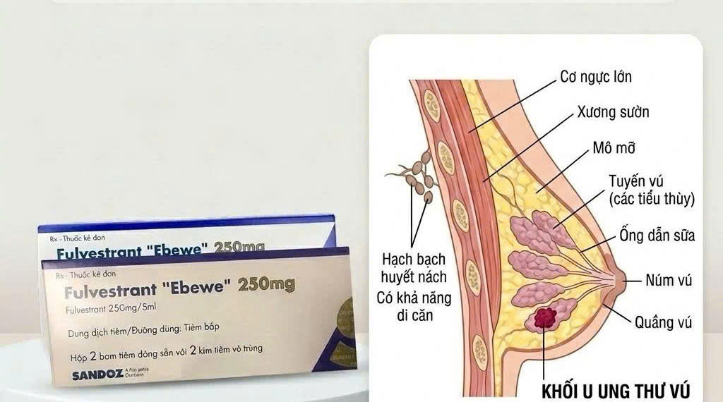 Fulvestrant Ebewe 250mg điều trị ung thư vú