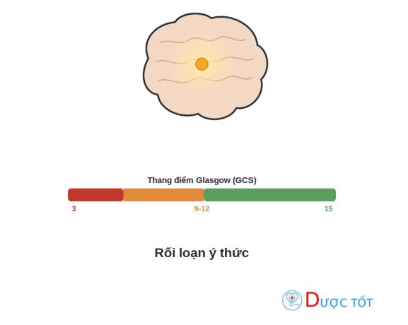 Rối loạn ý thức: Các mức độ và thang điểm Glasgow