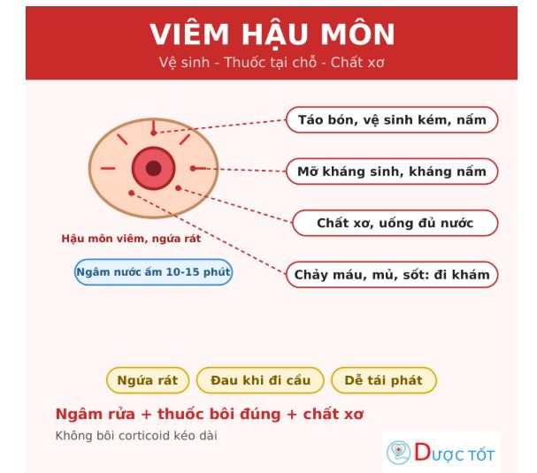 Viêm hậu môn: nguyên nhân, cách chăm sóc và điều trị đúng