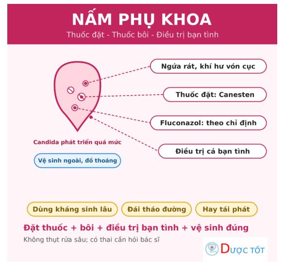 Nấm phụ khoa nguyên nhân cách điều trị và phòng tái phát