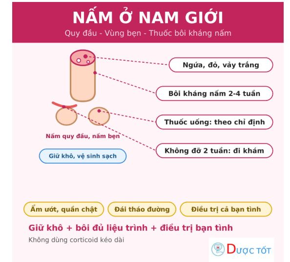 Nấm ở nam giới: nguyên nhân, cách điều trị và phòng ngừa